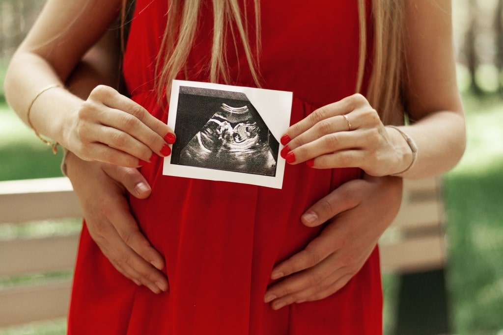 A happy married couple is holding in their hands a snapshot of an ultrasonic study of the baby. Husband hugs a beautiful adult pregnant wife. Second trimester.